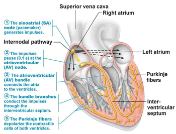 Pacemaker Implantation