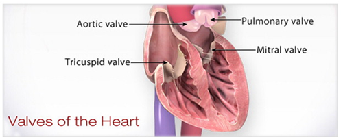 Heart valve replacement surgery