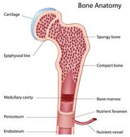 Bone marrow transplant