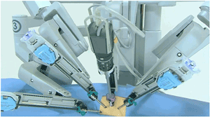 Robotic heart surgery
